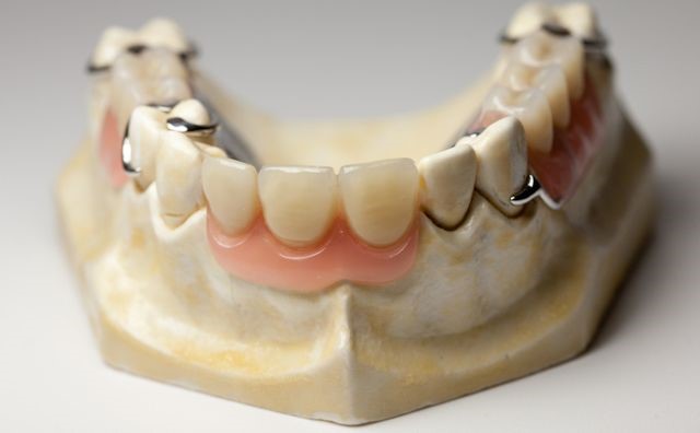 Lower Dentures Onaga KS 66521